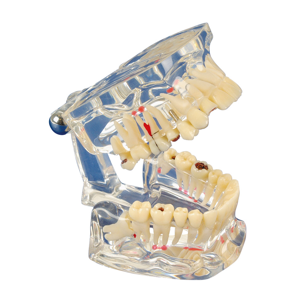 Studie model Transparent De Luxe, stk.