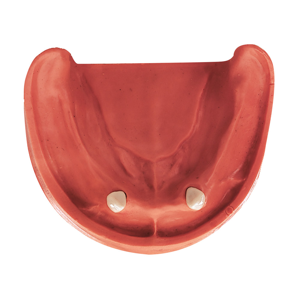 Gingiva Model UK TZ 2N, stk.
