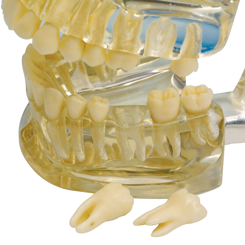 Studie-model Transparent, stk.