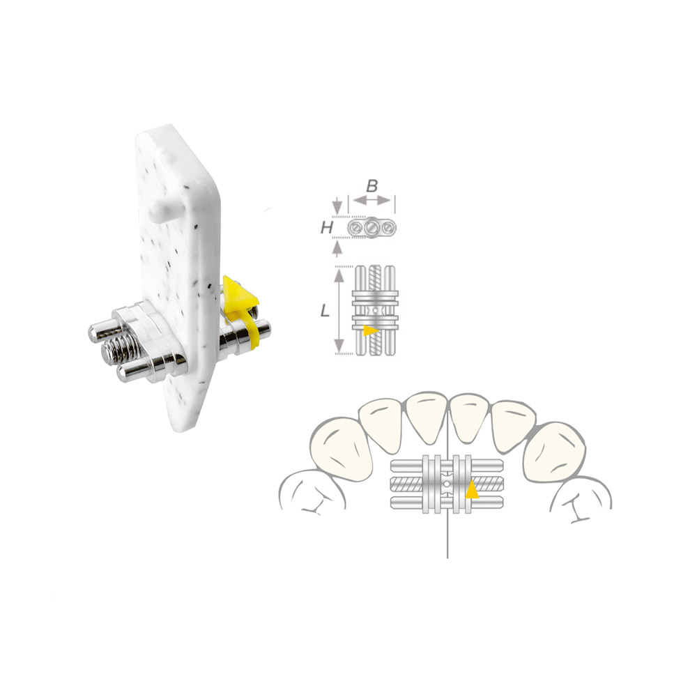 Spændeskive Vector 100 mini, 10 stk.