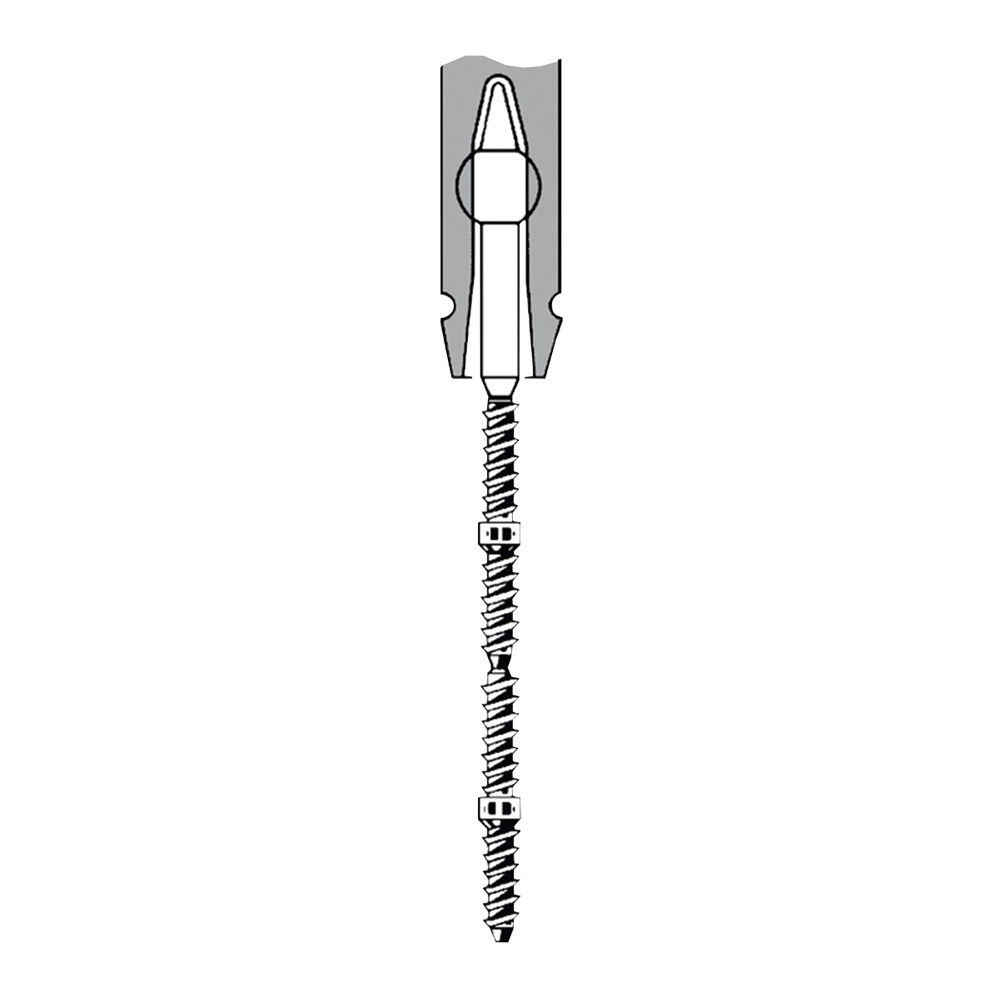 TMS Link plus Minim Titan stifter 0,525 mm sølv 24 stk. + tilbehør, sæt